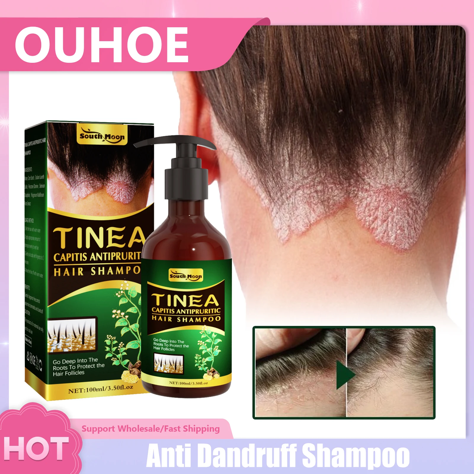 

Anti Dandruff Shampoo Treatment Eczema Scalp Psoriasis Deep Cleaning Relieve Itching Oil Control Seborrheic Dermatitis Shampoo