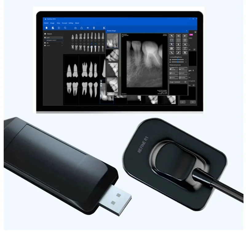 Датчик RC DynImage рентгеновский RVG быстрая передача цифровая Интраоральная система