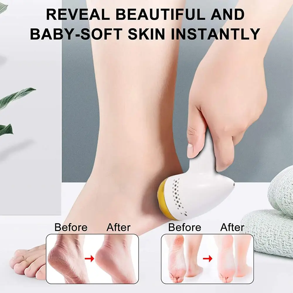 

Adsorption Dead Skin Machine Portable Foot Callus Absorbing Pedicure Remove Hard Dead Skin Foot Grinder Feet File