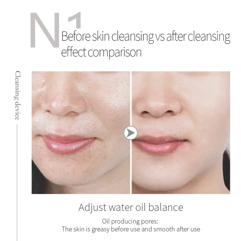Фото Hydra Bubble Skin Beauty Кислород для чистки лица Ультразвуковой скруббер для кожи Глубокая очистка лица Super Bubble Hydro Machine №5