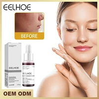 salicylic acid shrink pores serum fruit acid exfoliating moisturizing nourish smooth pores repair essence products skin care