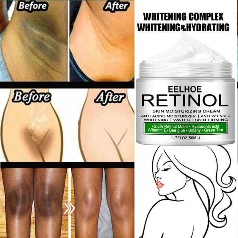 

Body Whitening Cream Underarm Knee Buttocks Private Remove Pigmentation Melanin Improve Body Dull Moisturizer Brighten Skin Care