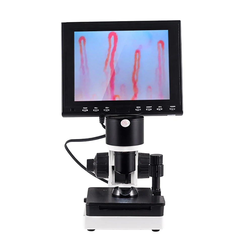 

SSCH blood capillary microcirculation microscope, capillaroscope, Subhealth detector