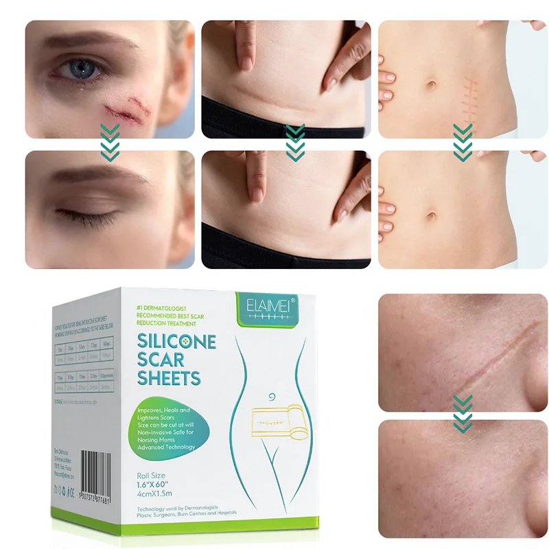 Крем для удаления шрамов от растяжек