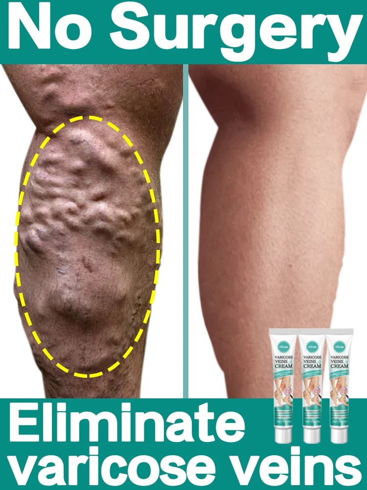 Промова кровь