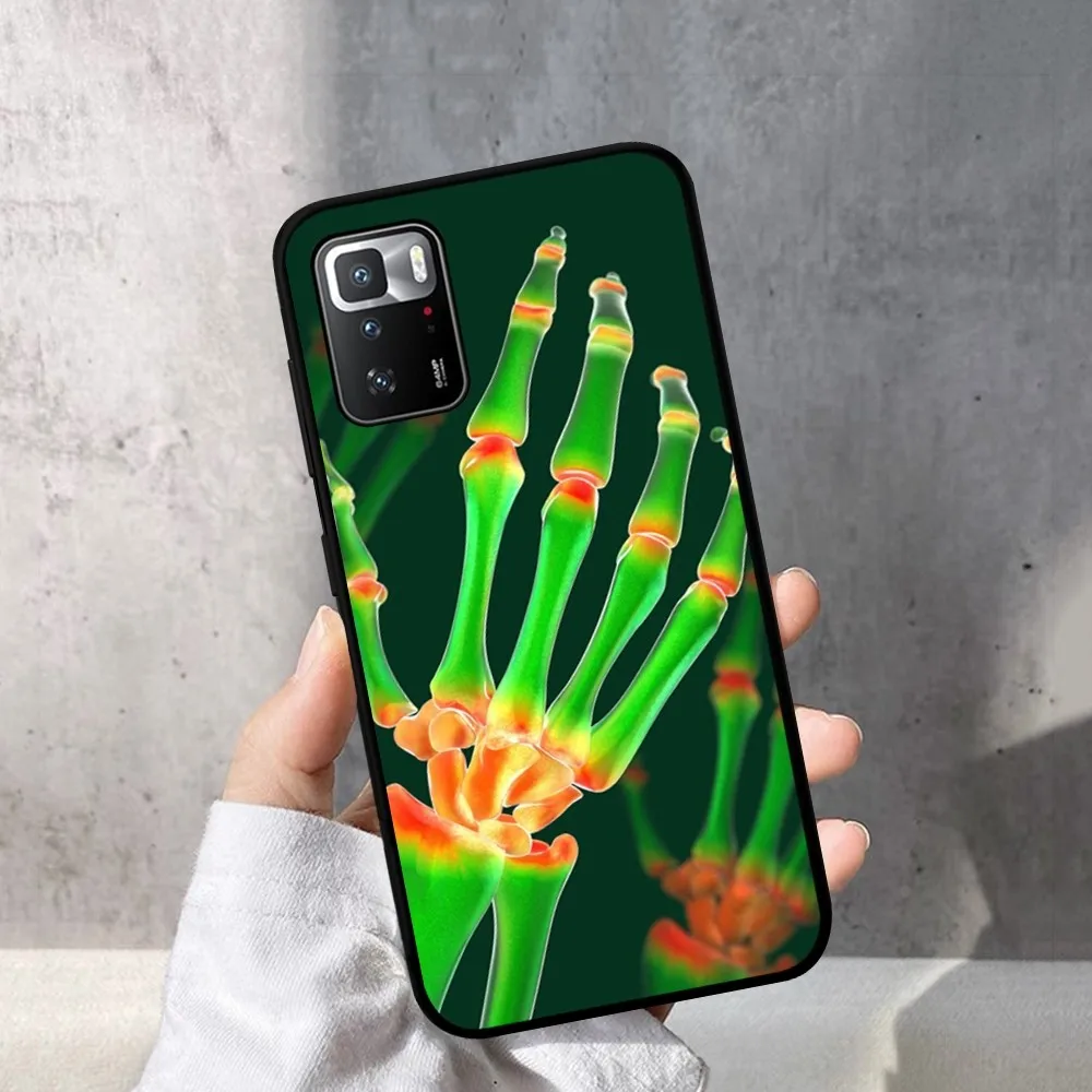 Радиологический каркас человеческих органов телефон планшетофон X 5 A 6 7 8 Pro T9 9S 10 11