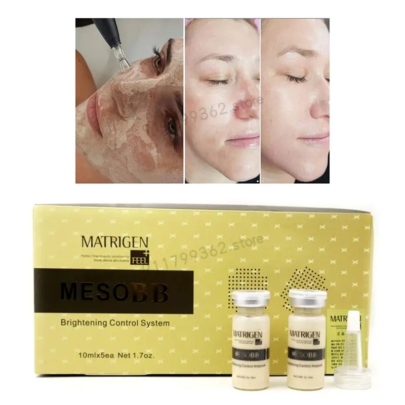 

5-Pack Korean BB Cream Glow Stayve Serum Meso White Brightening Serum for Whitening Acne Anti-Aging