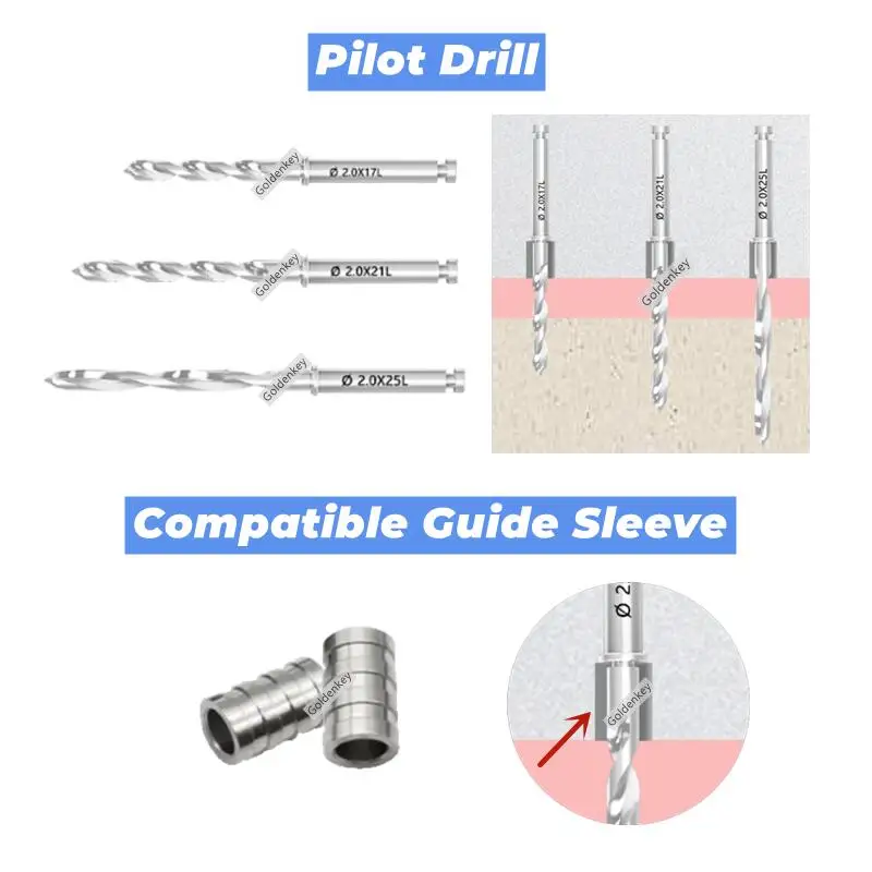 φ2.0 Направляющая для стоматологической пилота Рукав цифрового сканера Pioneer DSG