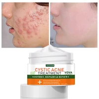 effective acne cream treatment acne anti acne lighten acne marks scars oil control shrink pores whitening moisturizing face care