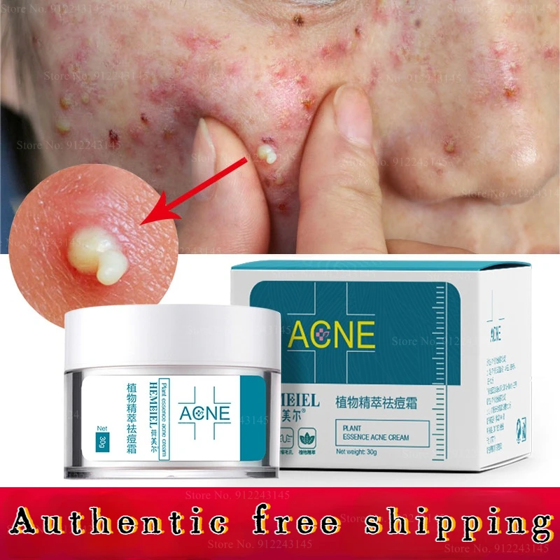 

Herbal Conditioning Acne Muscle To Acne Fade Acne Marks Moisturizing Repair Cream Repair Acne Essence Acne Cream