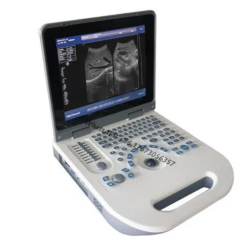 

B/w Diagnosis Equipment Laptop Notebook Digital LED Ultrasound Scanner Black and White