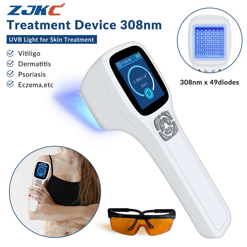 ZJKC 308nm Экксимерная система Фотодинамическая терапия УФ-световое устройство для