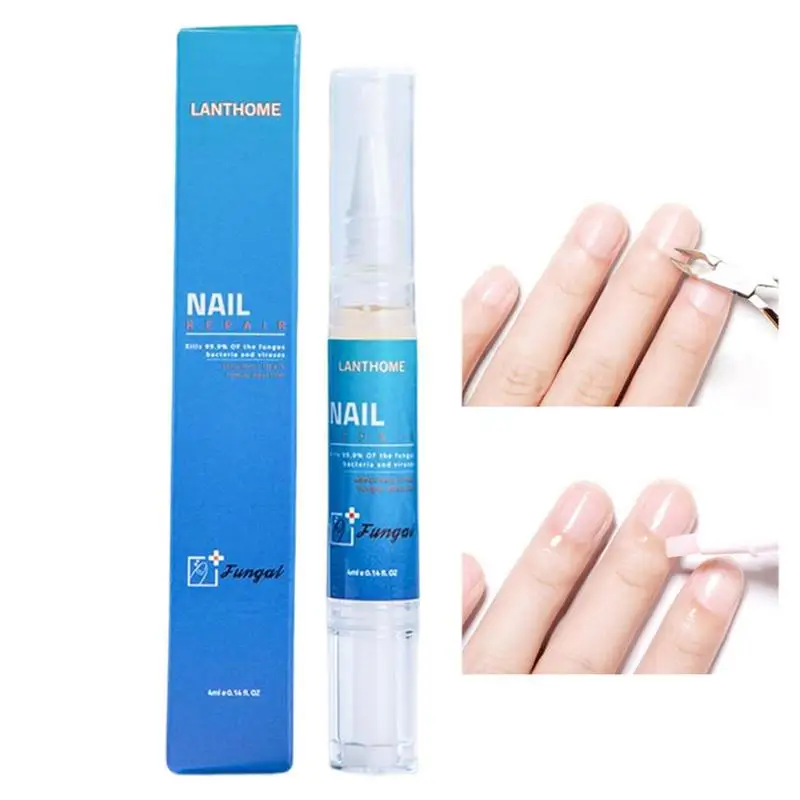 

4ml Nail Care Pen Thick Toenail Repair Nail Strengthener For Damaged Nails Moisturizer For Brittle Nails Home Nail Care Tool
