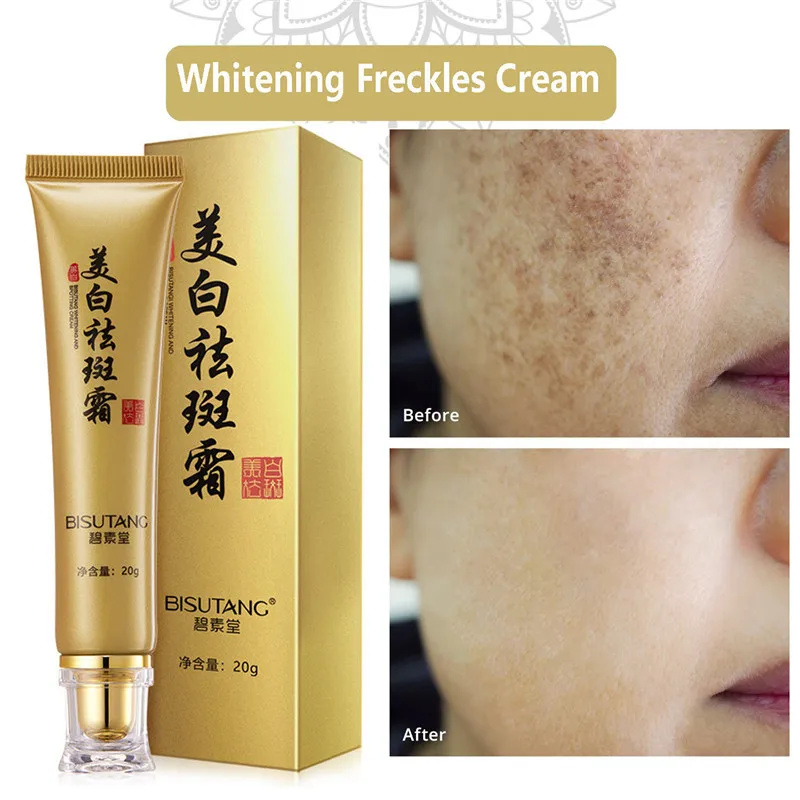 Whitening Freckles Removal Cream Fade Dark Spot Brighten Melanin Pigmentation Blemish Anti-Aging Moisturizing Lighten Skin Care
