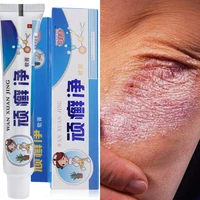 1pc psoriasis cream ointment treatment dermatitis eczema scaly plaques psoriasis tinea pedis relieve itching skin care cream 25g