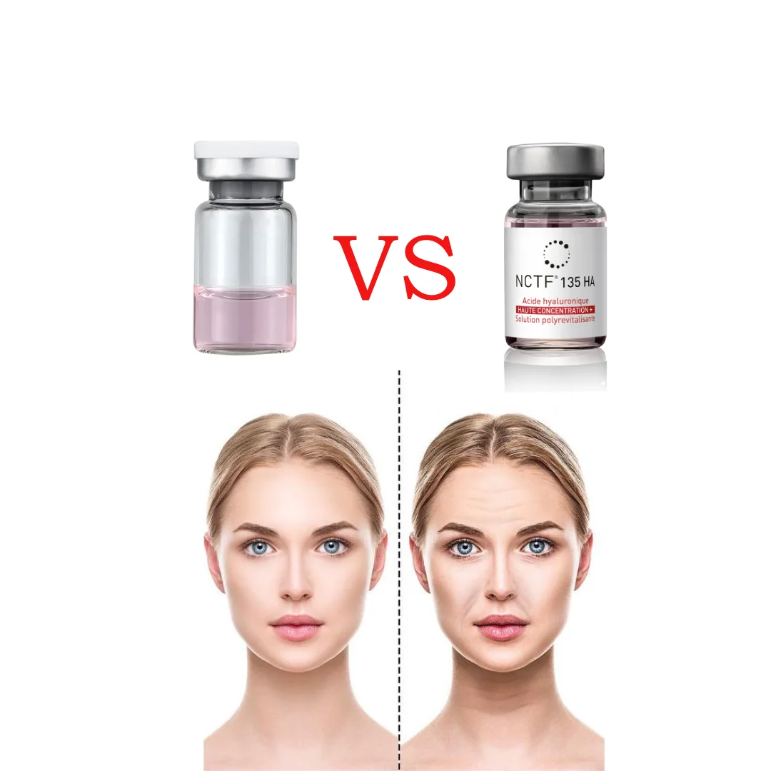 

2023 Mesotherapy Fillmed NCTF Boost 135HA Anti-Wrinkle Increase Collagen Production Restore Skin Collagen Solution Wholesale