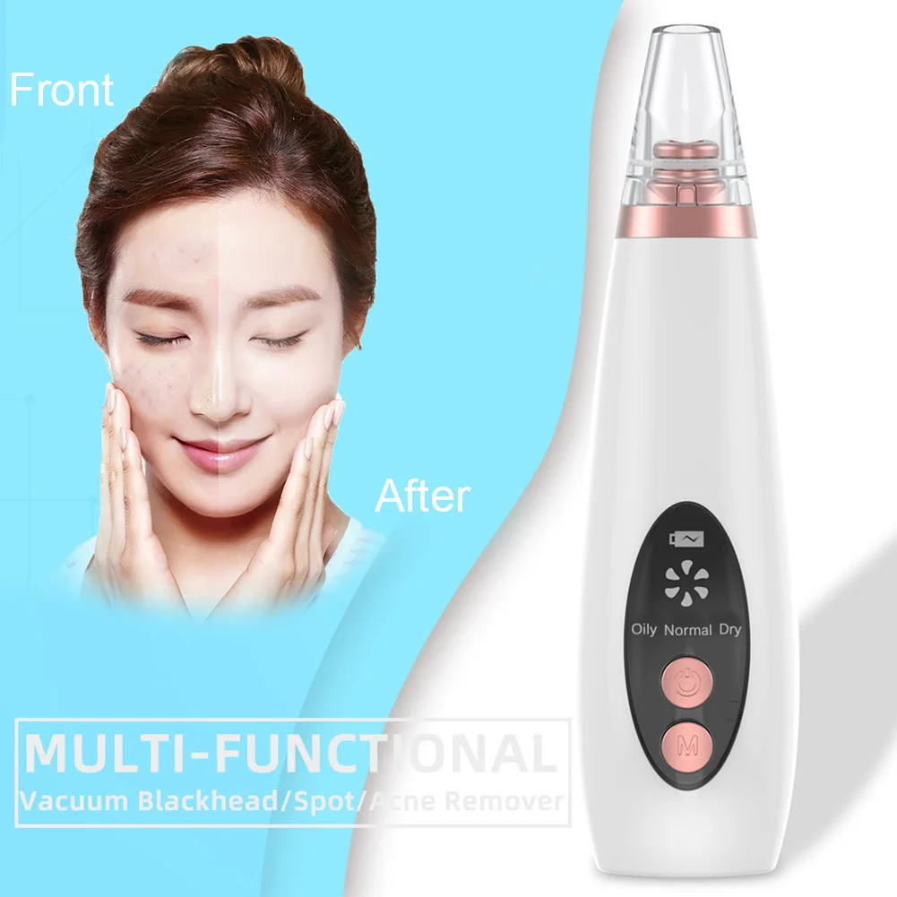

Portable Blackhead Remover Acne Pore Pimple Face Facial Cleansing Brush Exfoliator Firming Mini Skin Care Suction Vacuum Cleaner