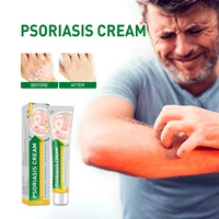 westmonth itching cream skin ringworm external use mosquito bites itchy hands and feet blister psoriasis cream free shipping