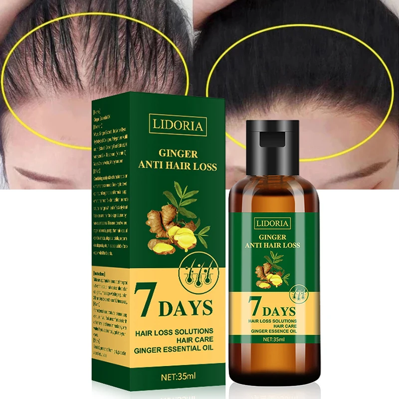 

Имбирь, средство для предотвращения облысения, жидкость для роста, средство против выпадения волос, питательный раствор для кожи головы