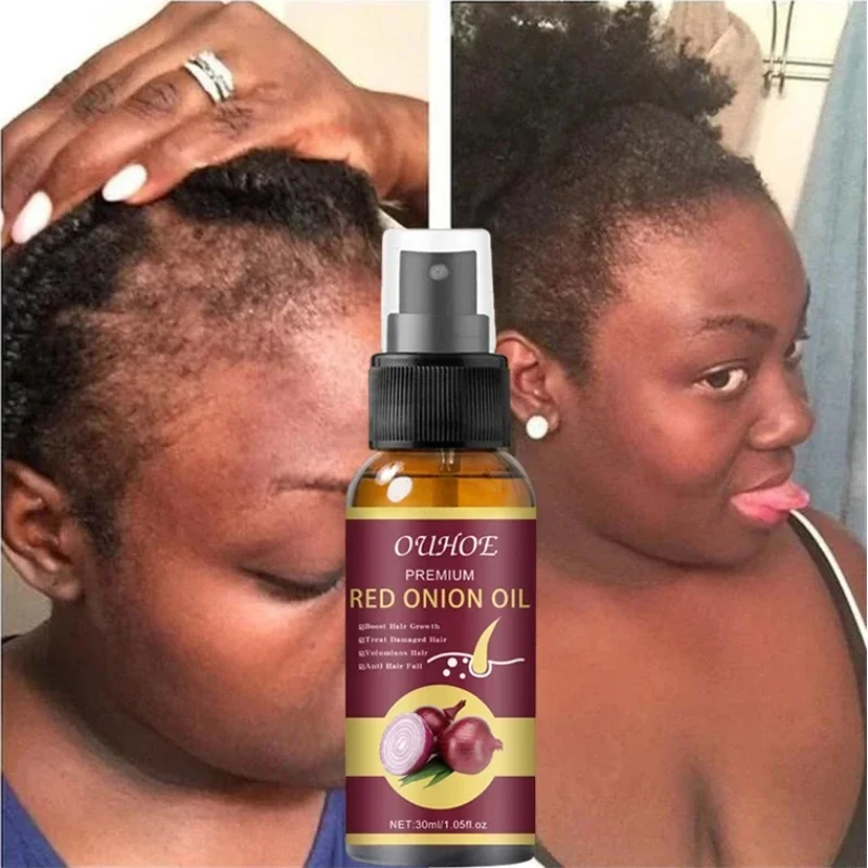 Масло для роста волос средство против выпадения эссенция восстановления и