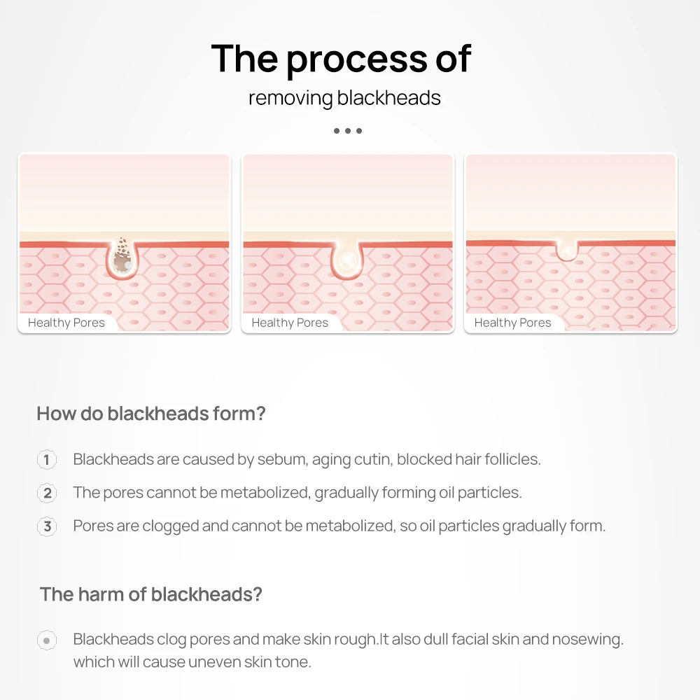 Средство для удаления черных точек LANBENA набор очищения пор на носу и лице