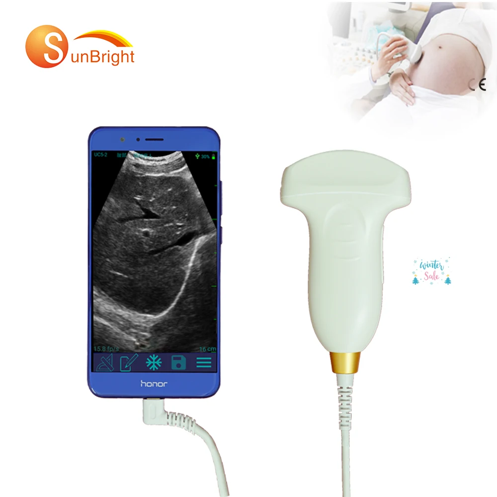 

Ultrasonic equipment with PW mode Obstetrics ultrasound probe convex type
