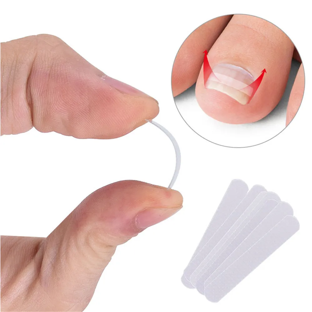 

10pcs Professional Toenail Correct Stickers Ingrown Toenail Tool Nail Repair Ingrown Toe Straightener Clip Paronychia Care Tools