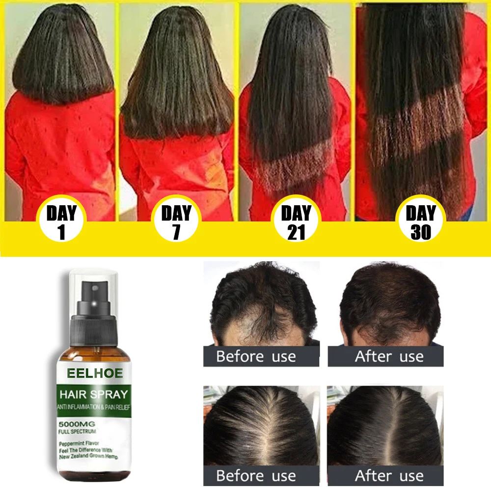 

Hot Sale Hair Growth Oil Spary Effective Hair Care Serum Healthy Hair Growth Stronger Hair Regrowth Treatments Nutritious 50ml