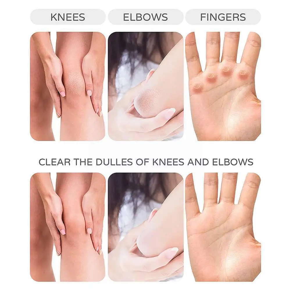 

Glass Pedicure Foot Rasp File Hard Dead Skin Callus Tools Professional Remover Skin Foot Pedicure Scrubber Care Grindi N3u1