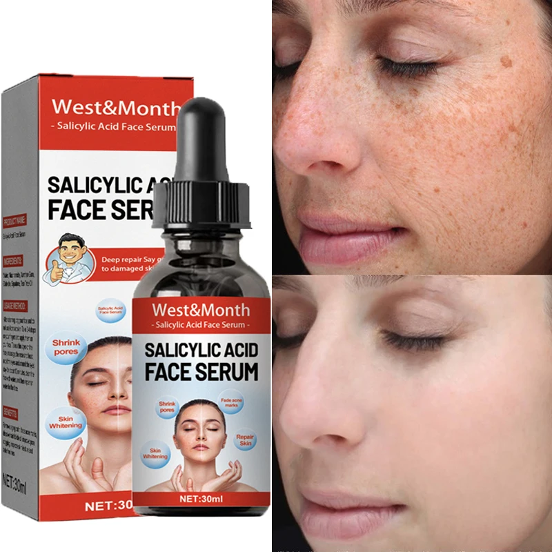 Salicylic Acid Whitening Face Serum Shrink Pores Fade Acne Marks Remove Blackhead Moisturizing Brightening Essence Skin Care