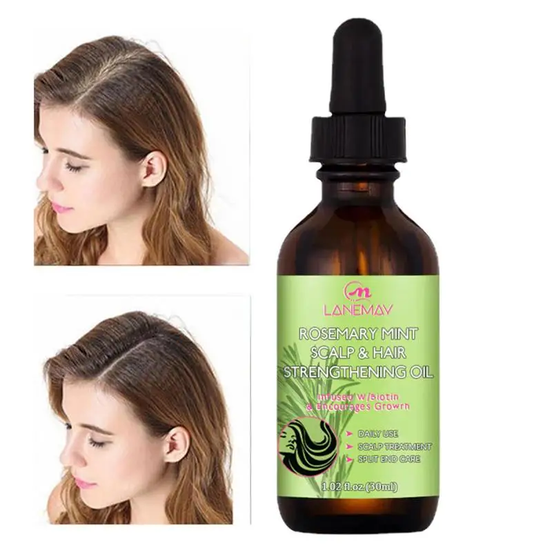 

Sdotter Rosemary Oil for Hair Organic Rosemary Mint Scalp & Hair Strengthening Oil Rosemary Oil With Biotin &Nourishing
