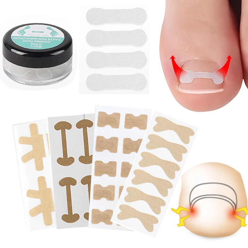 

4-20PCS Nail Correction Stickers Paronychia Treatment Ingrown Toenail Correction Elastic Straightening Clip Brace Pedicure Tools