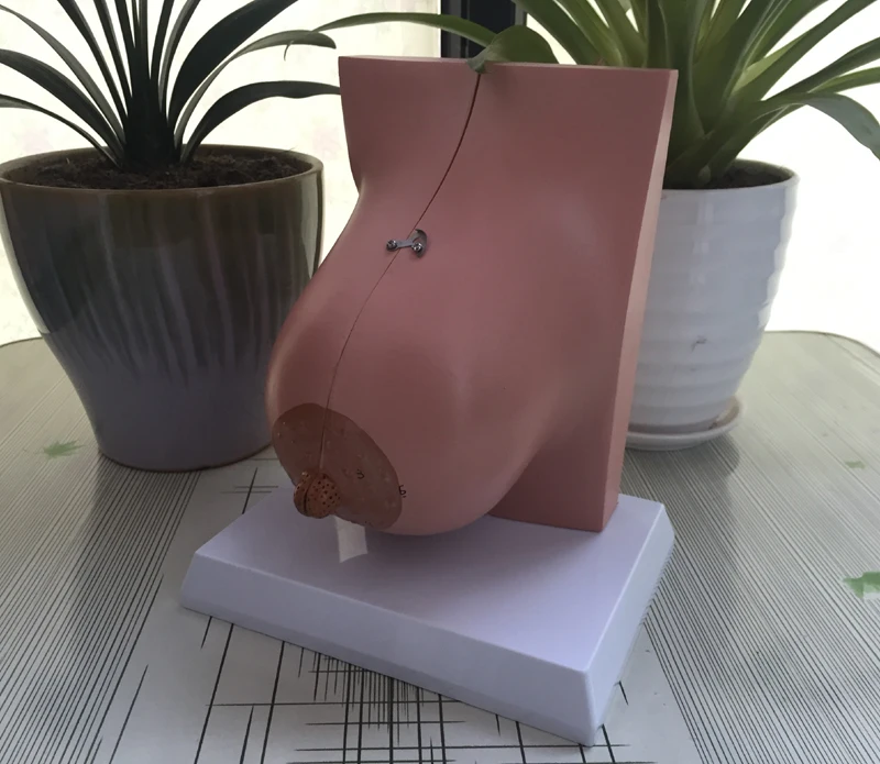 

Breast Anatomical Model During Lactation