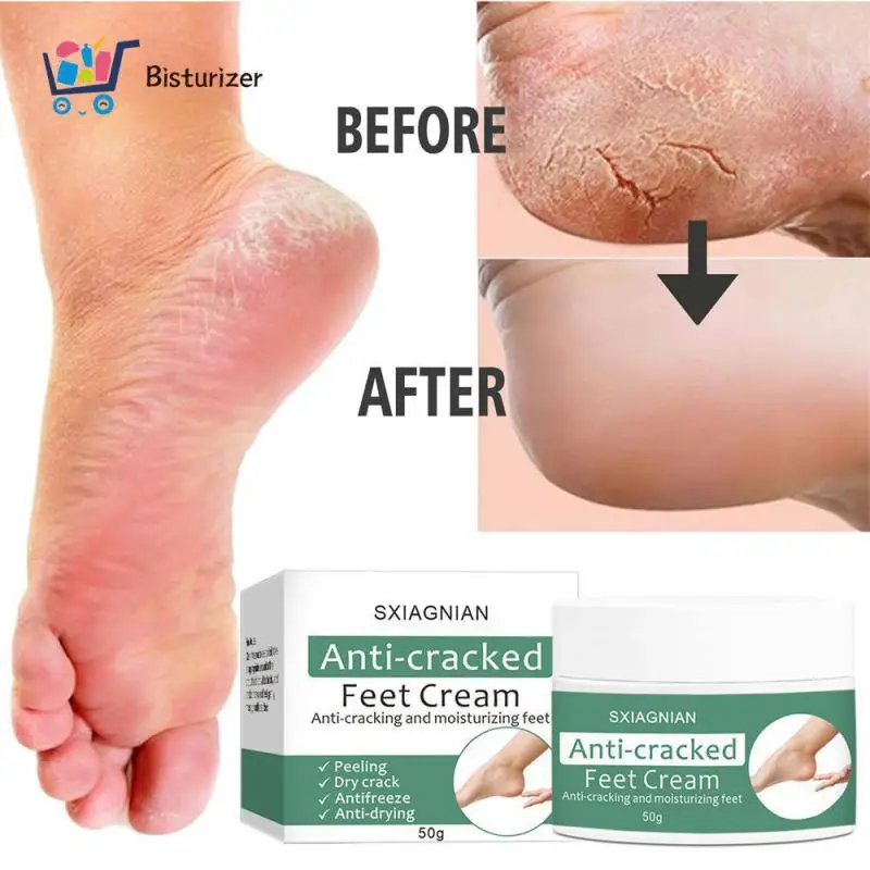 

Soothing Anti Drying Foot Cream Nourishes And Repairs Feet Anti Crack Foot Cream Chapped Repair Cream Revitalization Nature