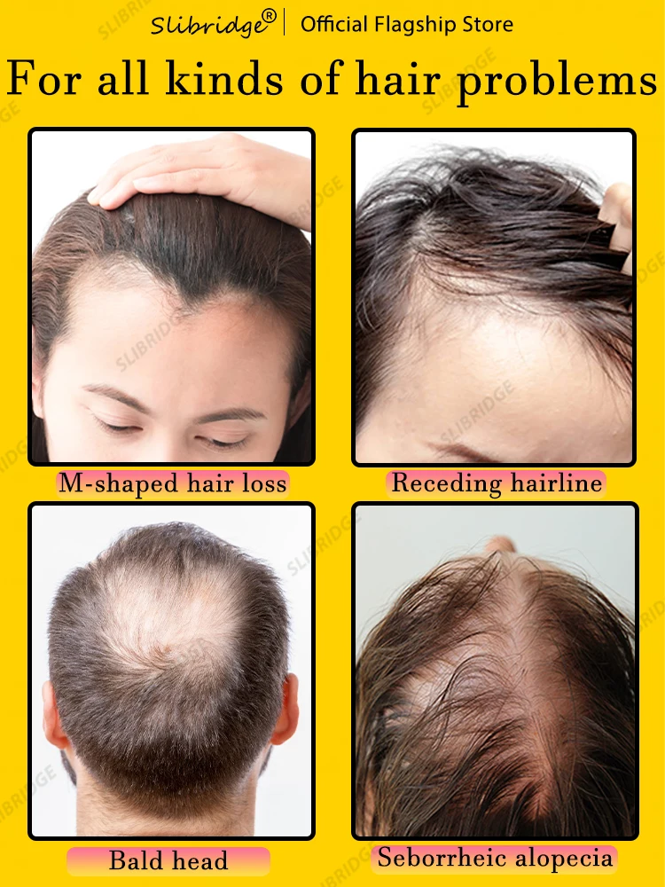 98% покупателей покупают снова у них все больше волос попрощайтесь с облысением