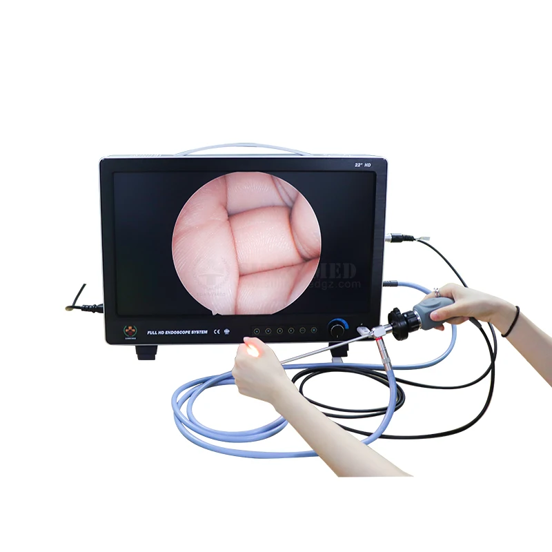 

SY-PS050 New Arrival 3CCD HD Camera Endoscope Video System for Laparoscopy Hysteroscopy Arthroscopy Fiber Endoscope
