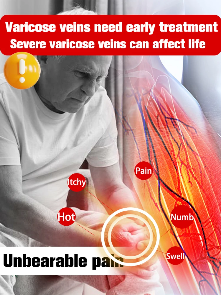 Крем-лазер Varicosse