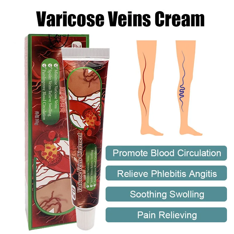 

20g Varicose Veins Ointment Treatment Vein Swelling Pain Dressing Effective Remove Leg Varices Promote Blood Flow Cream