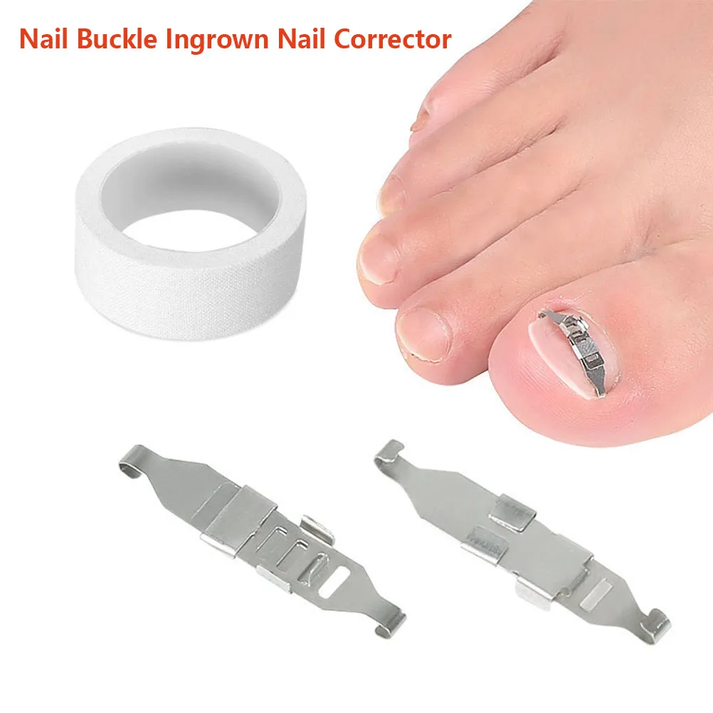 

Foot Care Tool Ingrown Toenail Corrector Tools Pedicure Recover Embed Toe Nail Treatment Professional Ingrown Toenail Correction