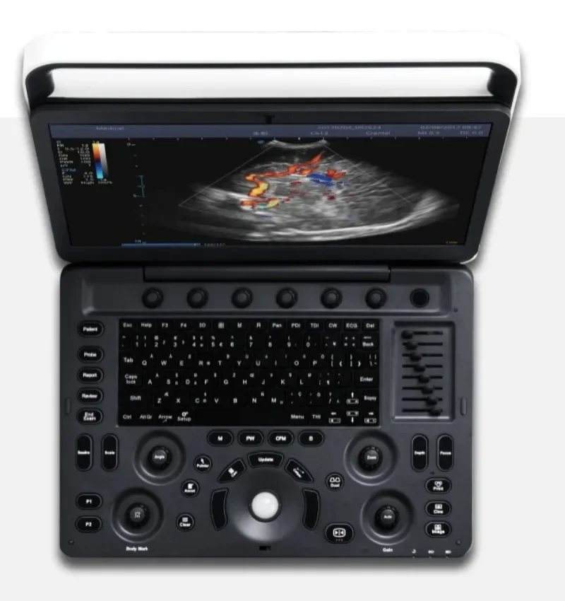 Медицинские ультразвуковые инструменты портативная ультразвуковая система