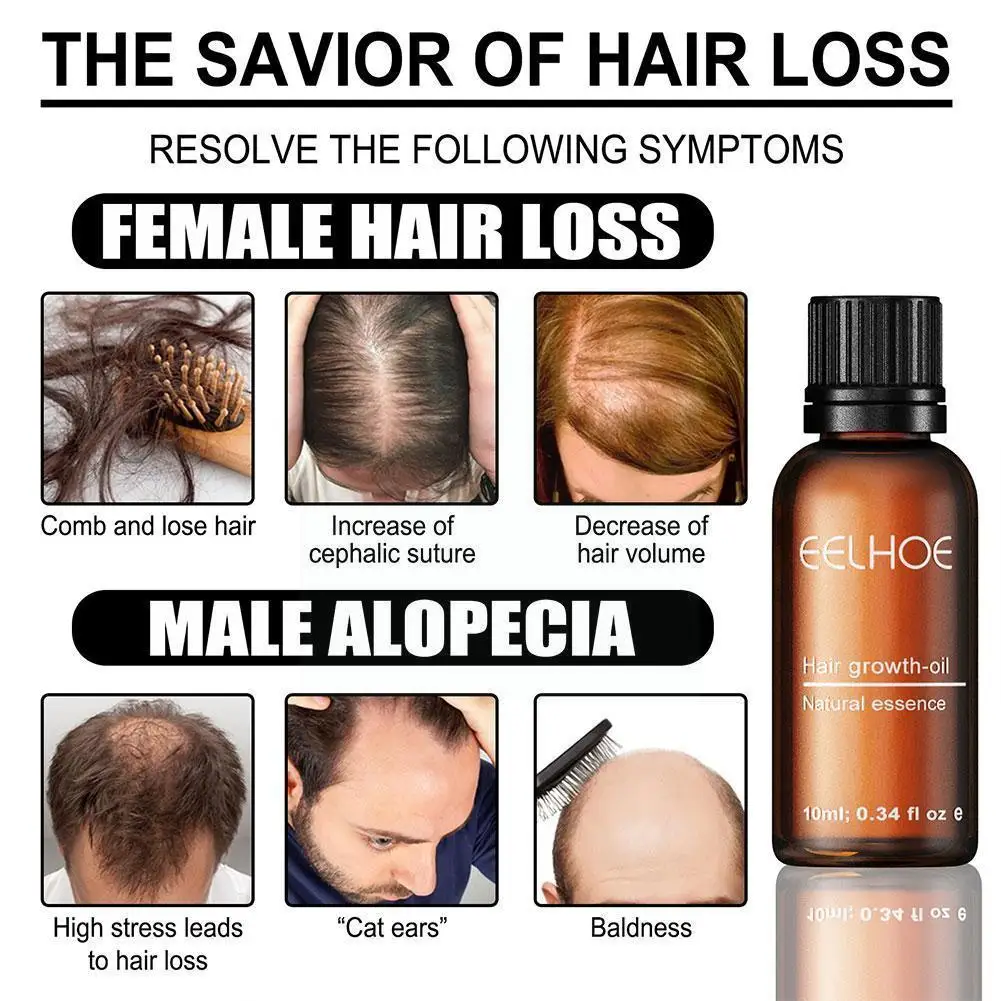 

Жидкость для роста волос, эфирное масло розмарина, масло для ароматерапии, масло для роста волос W6u0