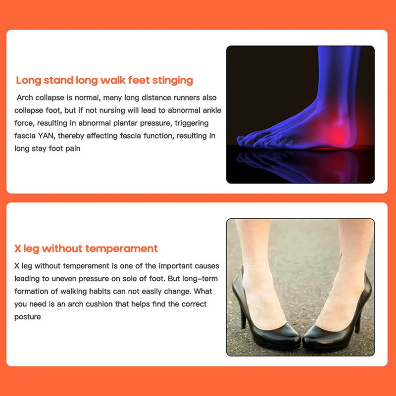 

1Piar Flatfoot Orthotics Insoles Unisex Orthopedic Adjuster Arch Support Orthopedic Insole O-Shaped Leg Flatfoot Corrector Pad