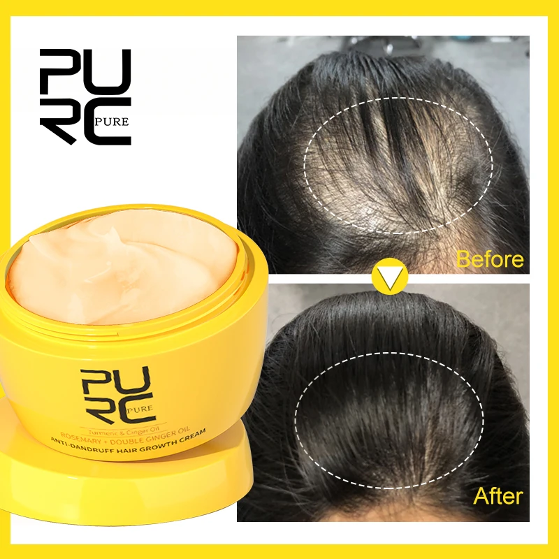 

PURC Ginger Hair Growth Anti-loss Hair Mask Repair Damaged Smoothing Scalp Treatment Oil Control Itching Hair Care Beauty Health