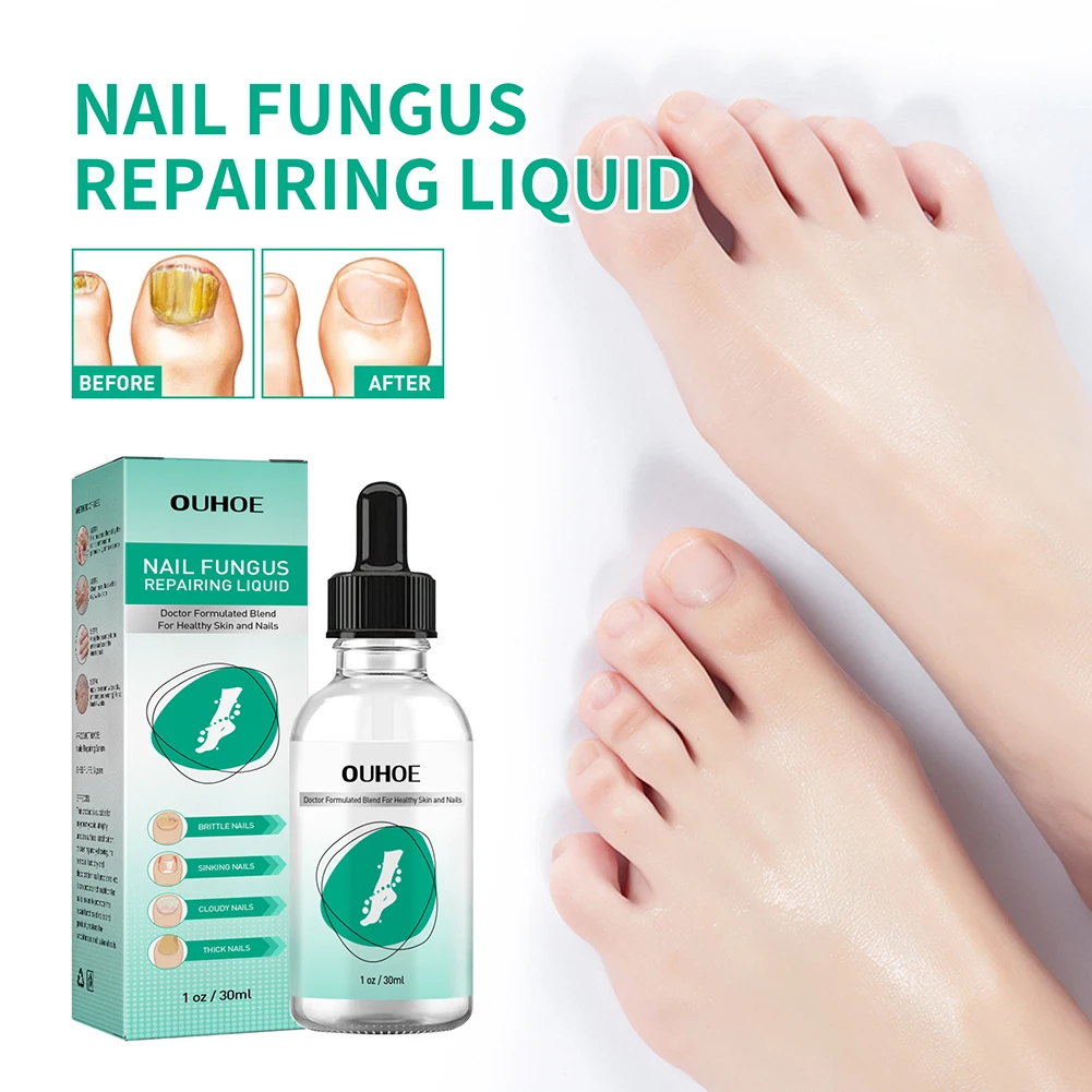 

30ml Anti Fungal Nail Repair Serum Care Foot Nail Fungus Removal Gel Anti Paronychia Onychomycosis Nail Care Repair Liquid