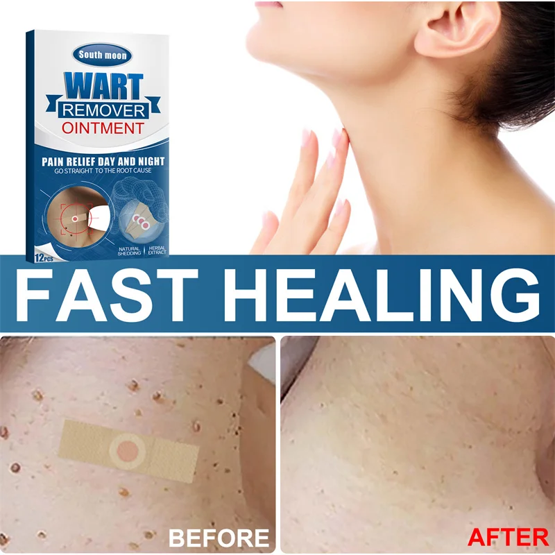 

12Pcs/Box Wart Removal Wart Removal Sticker To Repair The Usual Yuke Body Face and Neck Removal Sticker Facial Skin Care Tools