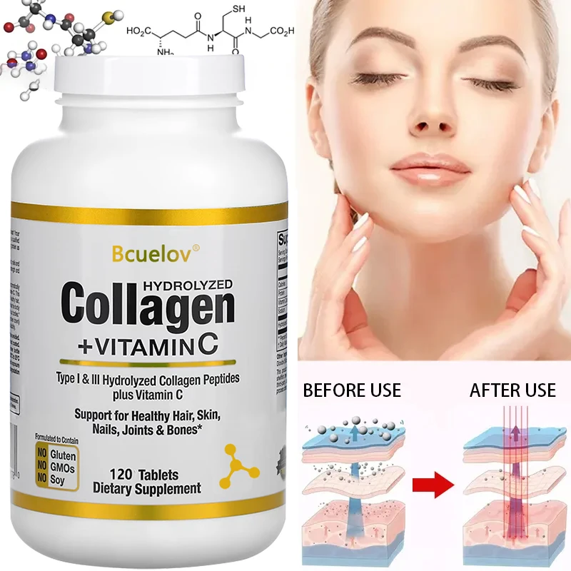 

Bcuelov Hydrolyzed Collagen Peptides + Vitamin C Supports Skin, Nails, Joints & Bones, Anti-Aging, Healthy Hair