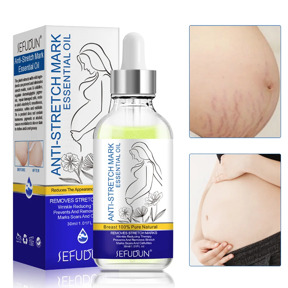 

Strech Mark Remover Cream Oil Removedor De Estrias Premama Embarazada Femme Enceintes For Pregnant Women Maternity Gravidanza