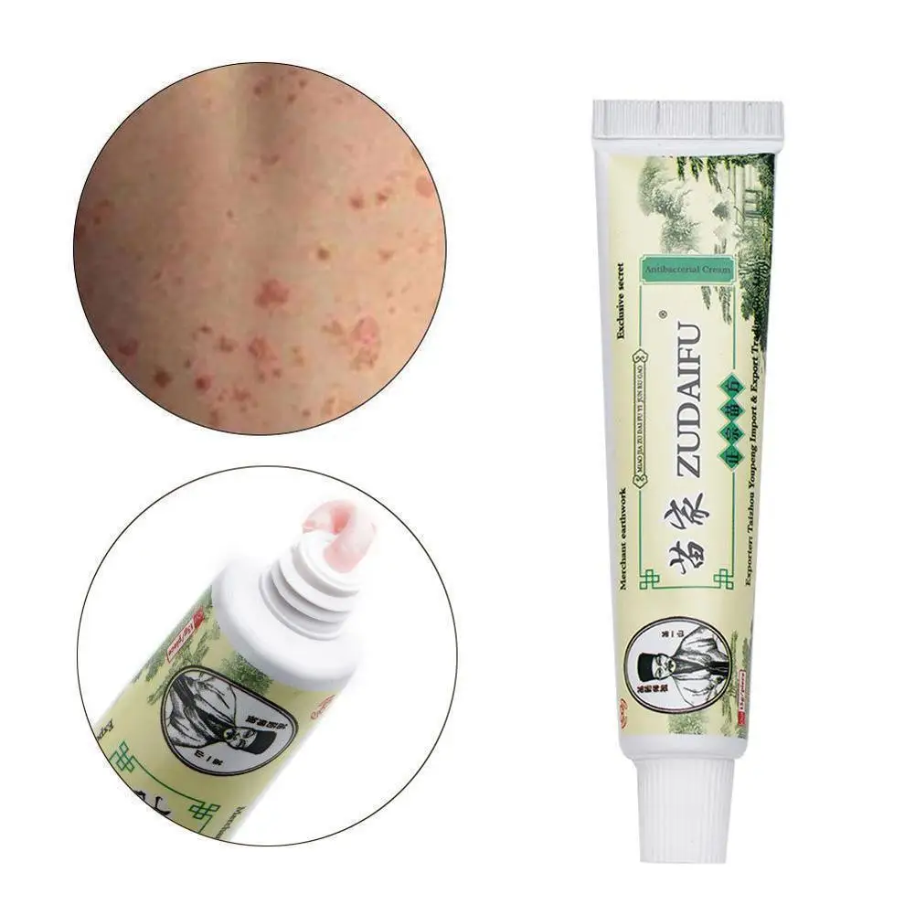 

3PCS Dropshipping Skin Psoriasis Cream Dermatitis Eczematoid Eczema Ointment Treatment Psoriasis Cream Skin Care Cream