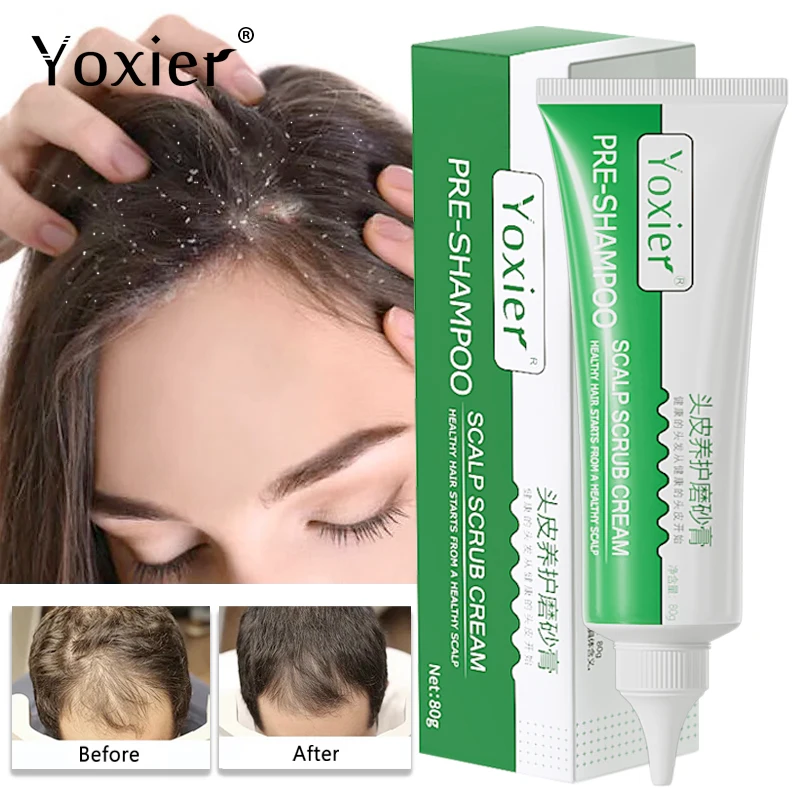 

Pre-Shampoo Scalp Scrub Clean Remove Dandruff Folliculitis Oil Control Prevent Hair Loss Repair Damaged Regrowth Nourishing 80g