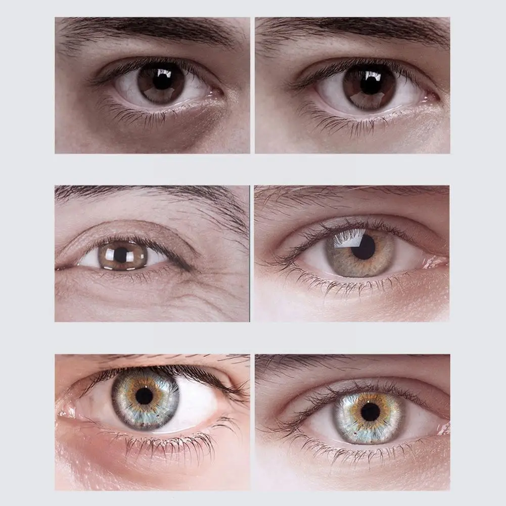 

20g Eye Cream Anti Anti-aging Remover Dark Circles Massage Serum Men Care Eye Eye Swelling Beauty Cream Eye E8v5